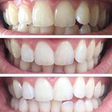 Whitening Toothpaste - 4 pack